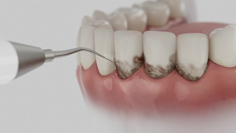 Reliable Dental contractor in Reading, PA by Smile Center Dentistry
